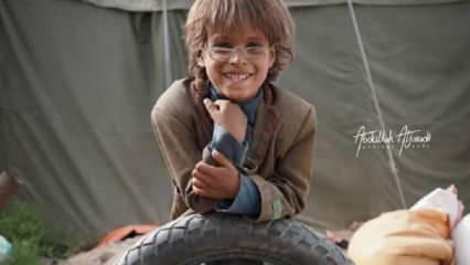 Yemenli mülteci çocuğun gözlüğü hayır için satıldı