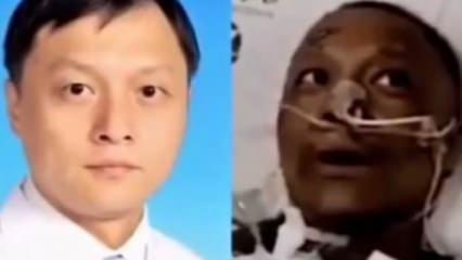 Koronavirüs yüzünden ten rengi değişen Çinli doktor Kovid-19'dan öldü