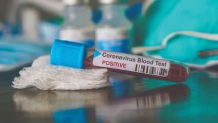 Kan grubu Koronavirüs'ün bulaşıcılığına etki ediyor