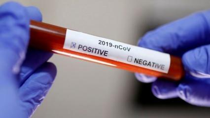 Koronavirüs ikinci dalga ihtimalinin en yüksek olduğu 10 ülke açıklandı