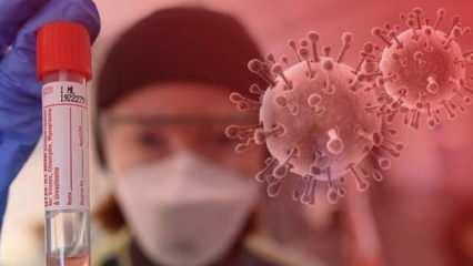 Resmen duyurdular: Koronavirüse 4 yeni belirti daha ekledi! İşte en yaygın 11 semptom