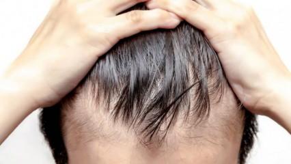  Genç yaşta saç dökülmesi neden olur? Saç dökülmesine karşı doğal çözümler...