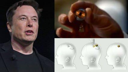 Elon Musk, insan beynini bilgisayara bağlayan Neuralink'i tanıttı