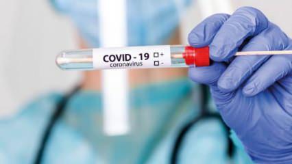 Koronavirüste korkutan yeni belirtiler! Uzun süreli etki bırakabilir