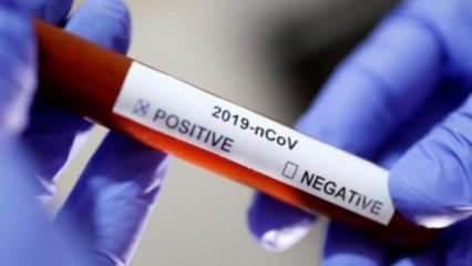 Gaziantep İl Sağlık Müdürü korona virüse yakalandı
