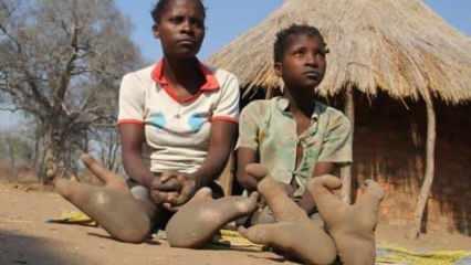 İlgin&ccedil; yer: 'Deve kuşu ayaklı' insanların k&ouml;y&uuml;!