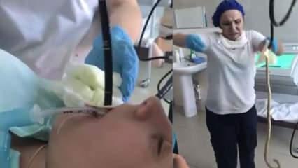 Kadının ağzından giren yılan ameliyatla çıkartıldı