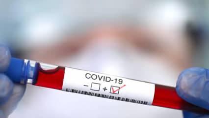 Kan grubu '0' olanlar corona virüse karşı daha avantajlı çıktı