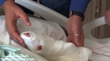 4 yaşındaki İsmail'in Erzurum'da kopan kolu Kayseri'de dikildi