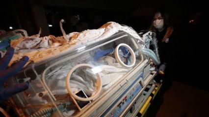 Suriye'de dünyaya gelen siyam ikizleri ambulans uçakla Ankara'ya getirildi