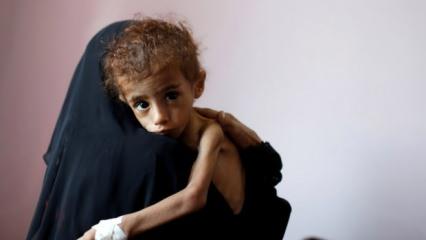 BM: Yemen, kıtlık tehlikesi ile karşı karşıya