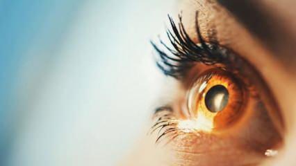 Göz seğirmesi nasıl geçer? Göz seğirmesine iyi gelen doğal tedavi yöntemleri...