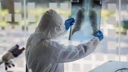 Rus bilim insanı açıkladı: Koronavirüse yakalanma riskini yüzde 250 artırıyor