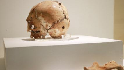 Dünyadaki ilk beyin ameliyatının yapıldığı Aşıklı Höyük tarihe ışık tutuyor