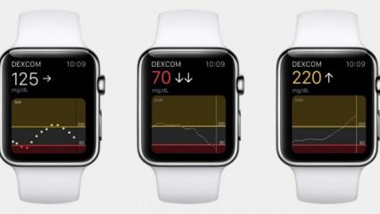 Apple Watch kan şekerini de ölçecek