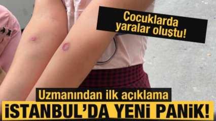 İstanbul'da sivrisinek paniği! Çocuklarda yaralar oluştu