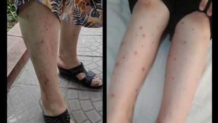 İstanbul'da sivrisinek kâbusu büyüyor! 4 ilçede daha görüldü