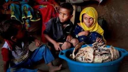 UNİCEF'ten şok Yemen raporu; Her 10 dakikada bir çocuk ölüyor
