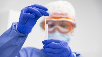 Bilim Kurulu Üyesi Özkan'dan uyarı: PCR testinin negatifliğine güvenmeyin