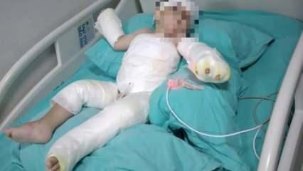İzmir'de koca dehşeti: Eşi ve bebeğini yaktı 