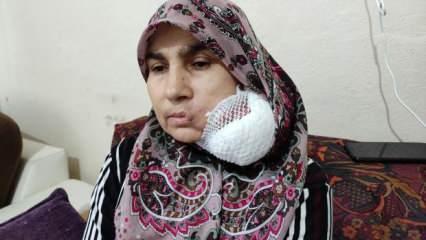 Bursa'da talihsiz kadın yüzündeki dev kitleden kurtulmak için yardım bekliyor