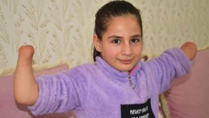 Doğuştan el ve ayak parmakları olmayan 11 yaşındaki Rabia protez el istiyor