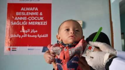 Yeryüzü Doktorları'nın 2021 Yemen raporu: Açılıkla mücadele