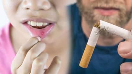 Günde 1 paket sigara içiyorsanız dikkat! Ağız kanseri riski 9 kat fazla
