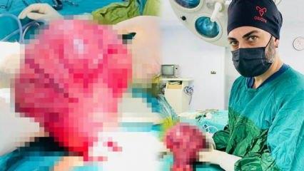Siirt'te 49 yaşındaki kadın karın ağrısıyla gitti, karnından 4 kiloluk kitle çıkarıldı