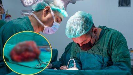 Ülkesinde iyileşemeyen Sudanlı hasta şifayı Türkiye'de buldu! 25 santimlik tümör çıkarıldı