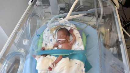 Tekirdağ'da 5,5 aylık doğan Yavuz Selim bebeğe kök hücre nakli yapıldı