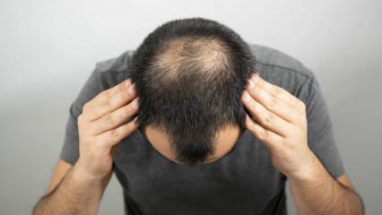Duygusal travmalar ani saç kayıplarına neden olabiliyor
