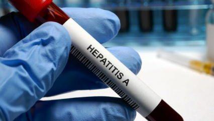 DSÖ açıkladı: Gizemli hepatit vakaları 650'ye, can kayıpları 9'a yükseldi
