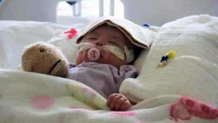300 binde bir görülen rahatsızlığa yakalanan Aisha bebek, yaşam mücadelesini kazandı
