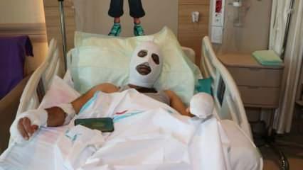 Gaz kaçağını fark etmedi hastanelik oldu! Yüzü ve elleri yandı