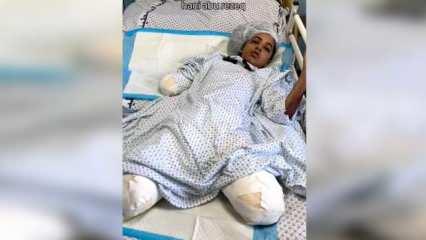İki bacağı ve kolunu kaybeden Gazzeli kız Erdoğan'a seslendi