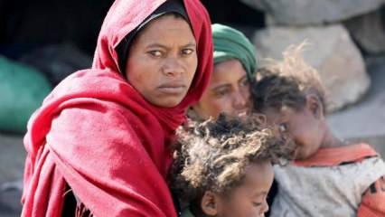 BM'den Yemen'deki gıda krizi için 44 milyon dolarlık insani yardım