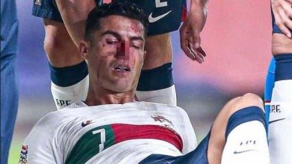 Maçta korkutan sakatlık! Ronaldo kanlar içinde kaldı
