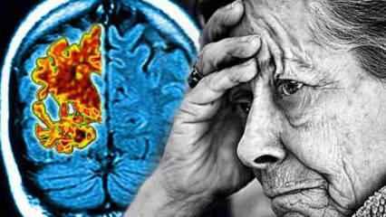 Alzheimer'ı teşhis eden kan testi geliştirildi
