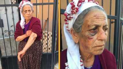 Adana’da korkunç olay: Hasta yaşlı kadının evine girip dakikalarca döverek gasp etti! 