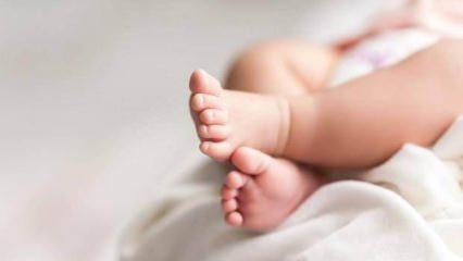 Bir yaşındaki bebeğin beyninden hiç doğmamış ikizi çıkarıldı!