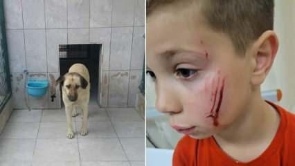 Bursa'da başıboş sokak köpeği saldırısı! Küçük çocuğun yüzünü parçaladı