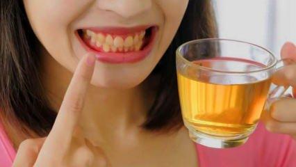 Çay yüzünden sararan dişlere çözüm: Diş lekeleri nasıl geçer, çay ve kahve dişlere zararlı mı? 