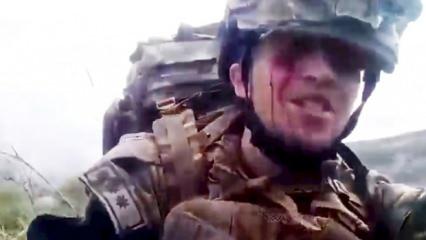 Karabağ'da yaralı halde çektiği videoyla duygulandıran askerin ölmediği ortaya çıktı!