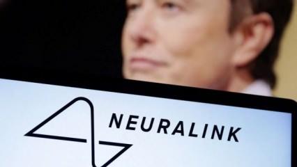 Neuralink onay aldı: Beynine çip taktırmak isteyen insanlar aranıyor!
