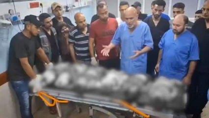 Gazze'de katliamın görüntüsü vardı, sesi de doktorlar oldu: "Ey özgür dünya neredesiniz?"
