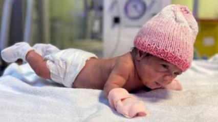 515 gram doğan Elif bebek hayata tutundu