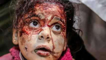 İsrail Gazze'yi kana buladı! Onlarca çocuk yaralandı