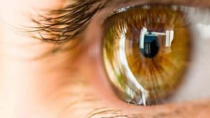 Sarı nokta hastalığı nedir, tedavisi var mı?  Gözde sarı nokta hastalığı neden olur?