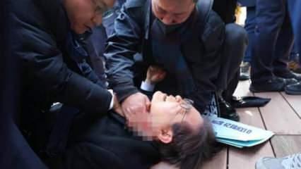 Muhalefet lideri boynundan bıçaklanmıştı, işte son durumu!